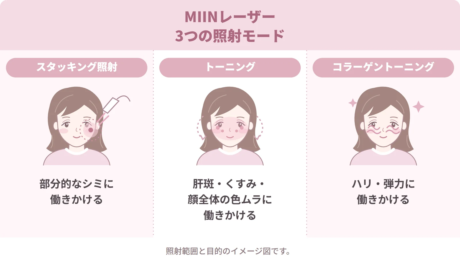 MIINレーザーの3つの照射モード。スタッキング照射は部分的なシミ、トーニングは肝斑・くすみ・顔全体の色ムラ、コラーゲントーニングはハリ・弾力に働きかけます。照射範囲と目的のイメージ図。