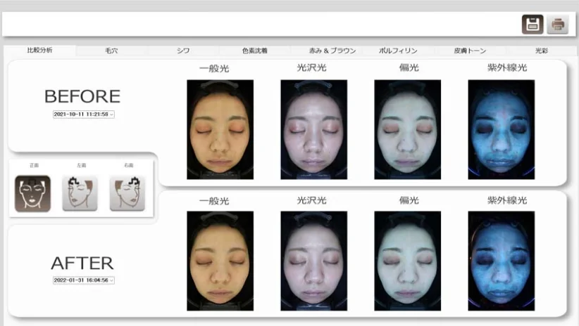肌診断機による撮影結果の比較画面