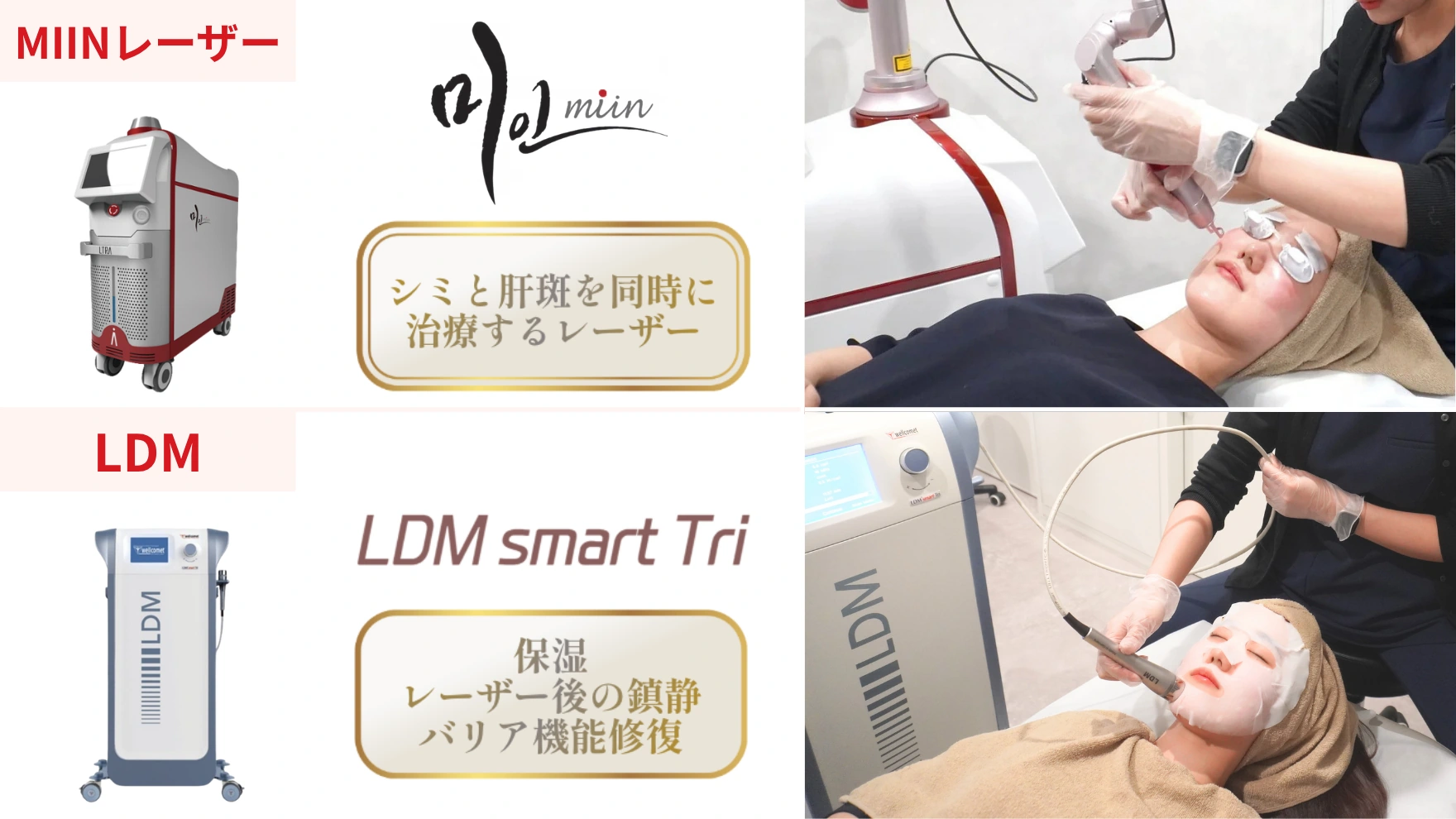 MIINレーザーとLDMの施術風景と使用機器の紹介