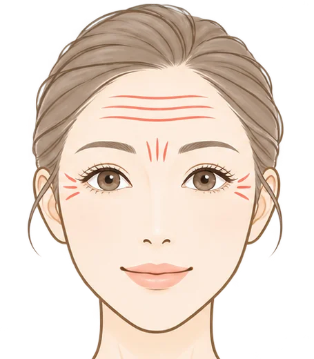 表情じわのイラスト