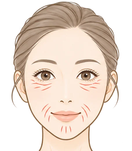 小じわ・ちりめんじわのイラスト