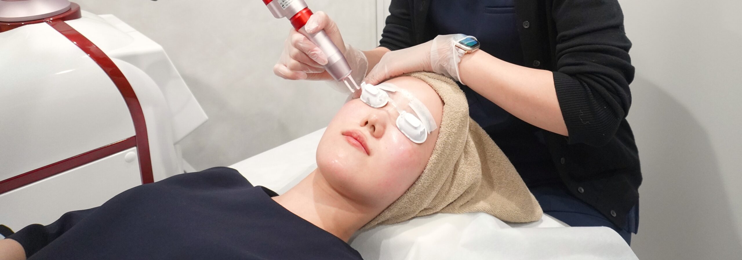 MIINレーザー施術の様子