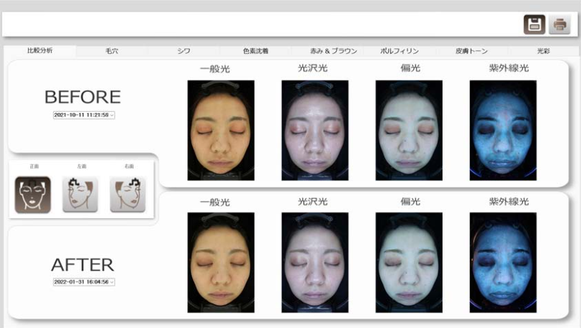 段階的な肌の改善イメージ